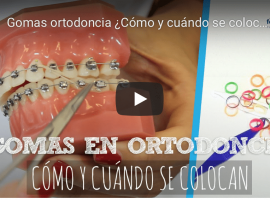 Vídeo tratamientos dentales Ferrus&Bratos