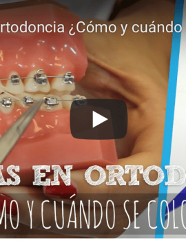 Vídeo tratamientos dentales Ferrus&Bratos