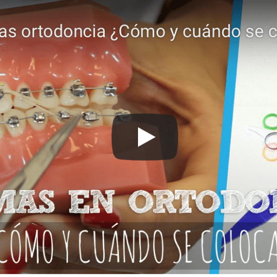 Vídeo tratamientos dentales Ferrus&Bratos