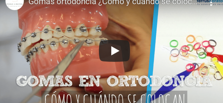 Vídeo tratamientos dentales Ferrus&Bratos