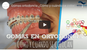 Tratamientos ortodoncia